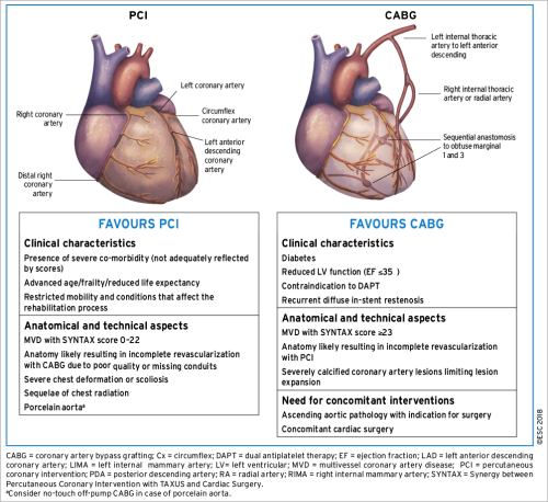 Aspects To Be Considered By The Heart Team For Decision making Coronary Artery Bypass Surgery